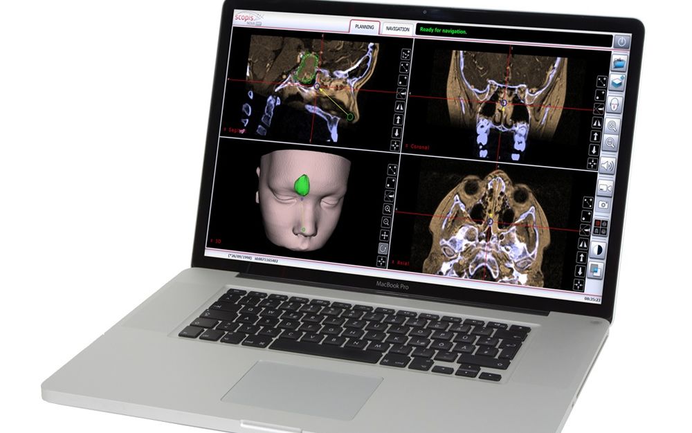 Aprueban un sistema de realidad aumentada para la cirugía otorrinolaringológica