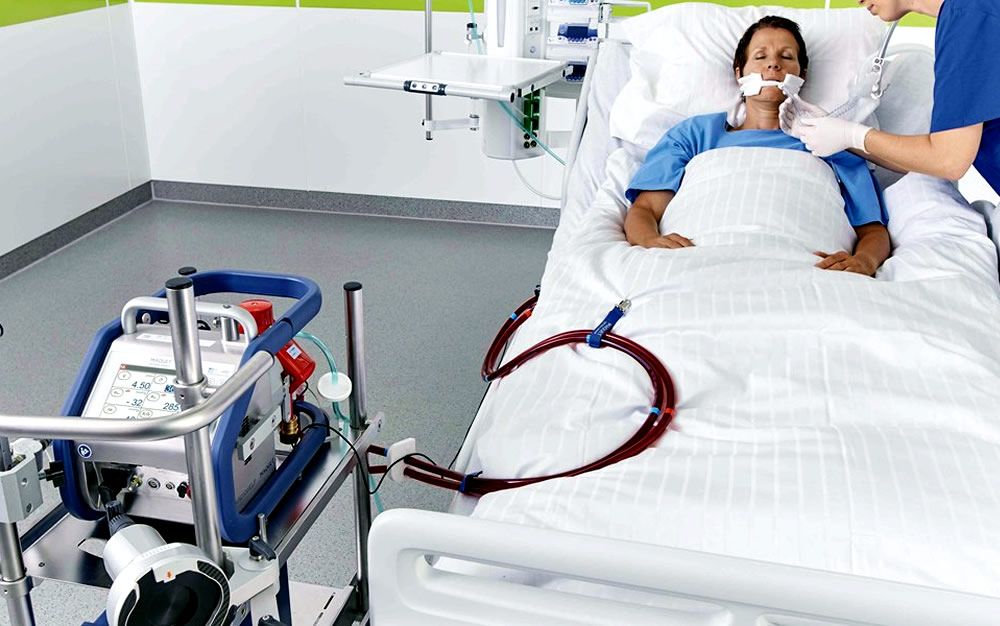 Los pulmones artificiales que salvan vidas en los hospitales españoles