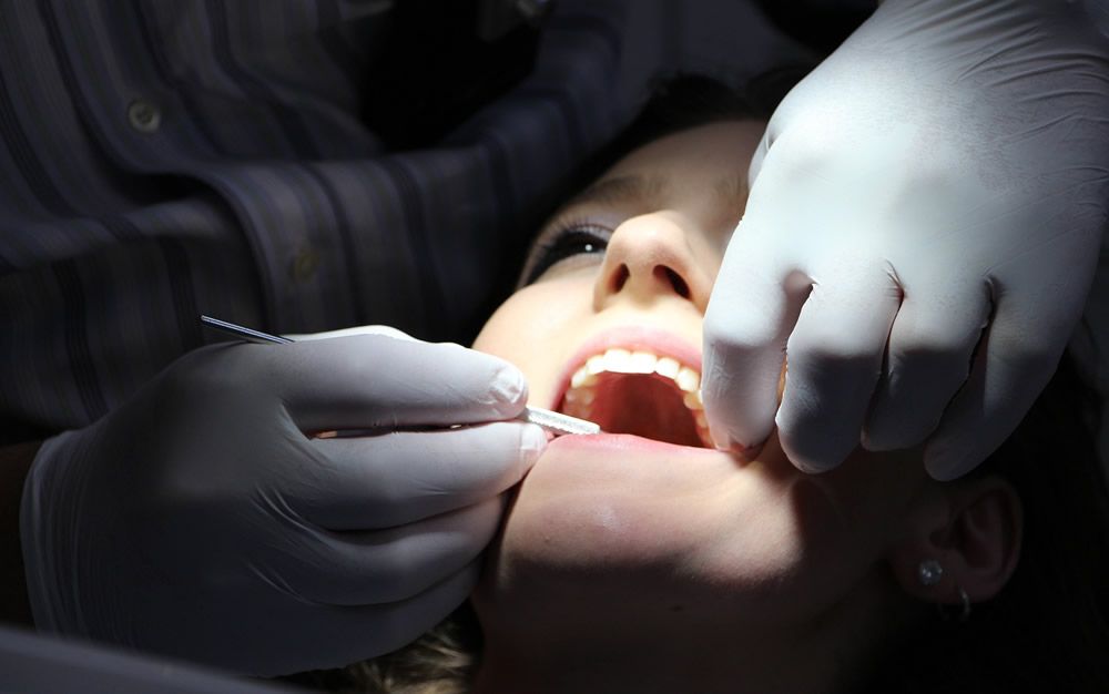 Nuevos biomateriales dentales frenan las consecuencias de la caries