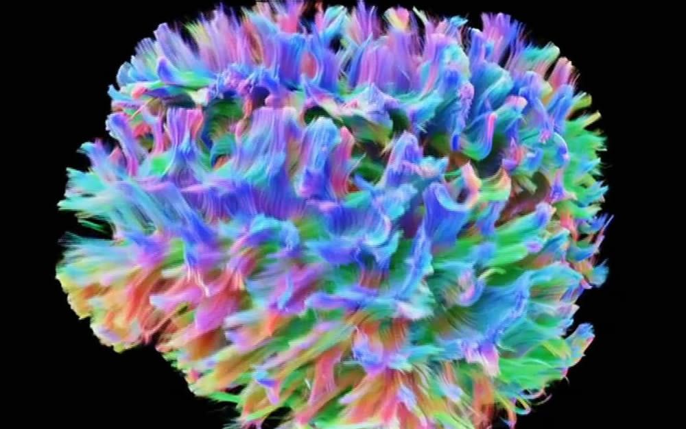 Un nuevo escáner revoluciona la precisión por imagen de la función cerebral humana