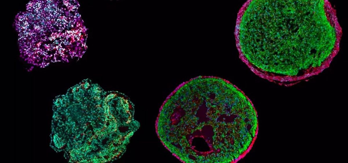 Organoides fabricados a partir de células madre pluriopotentes (Foto. Universidad de Munich)