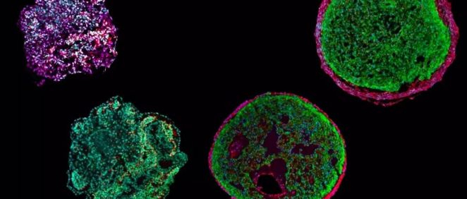 Organoides fabricados a partir de células madre pluriopotentes (Foto. Universidad de Munich)