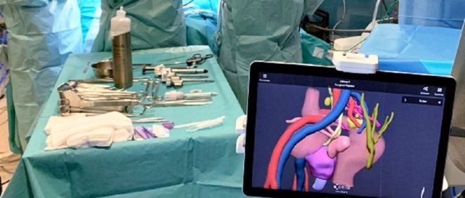 La tecnología 3D mejora los resultados de la cirugía en la enfermedad de Crohn (Foto. EP)