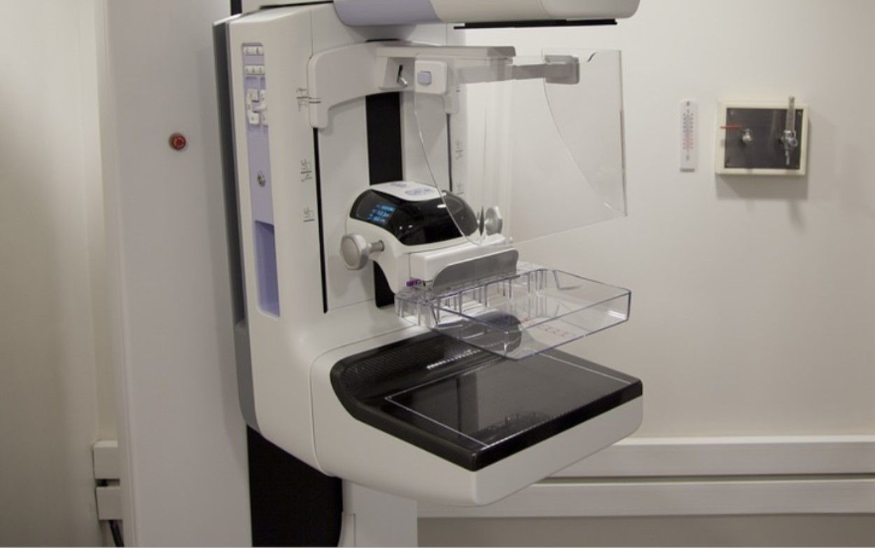 El Hospital Quirónsalud Sur incorpora un nuevo mamógrafo digital