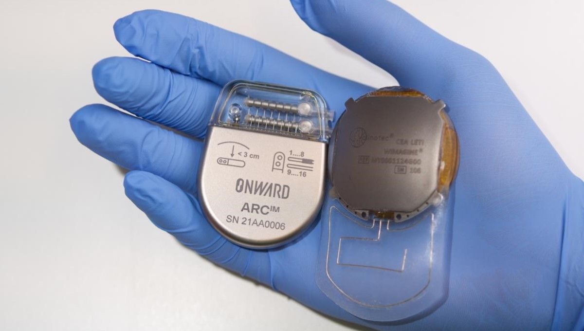 Implantes de ONWARD (Foto. ONWARD)