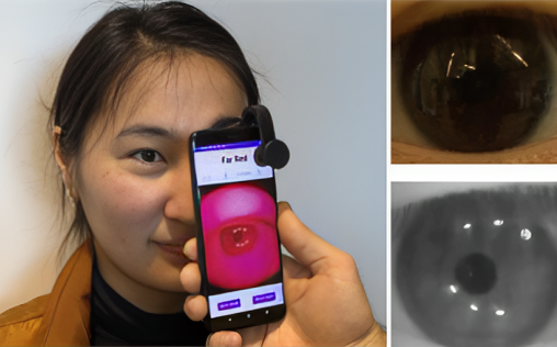 Crean un filtro para el móvil que detecta patologías cerebrales independientemente del tono de piel