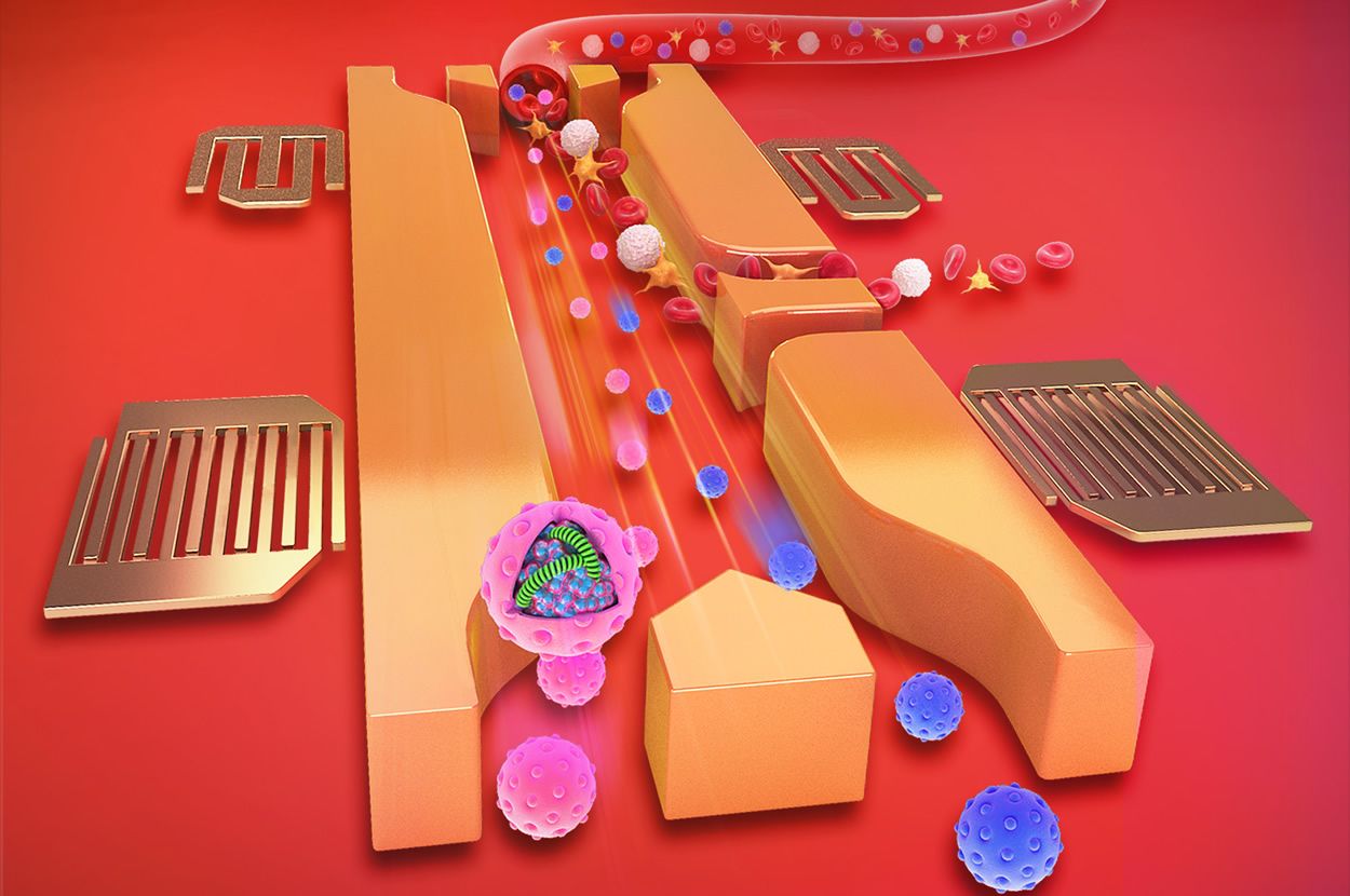 El esquema muestra un dispositivo microfluídico que usa ondas de sonido para separar los exosomas (esferas rosas) de otros componentes de la sangre. (Courtesy of Mengxi Wu, Ming Dao, Subra Suresh, Yoel Sadovsky and Tony Jun Huang). Imagen del MIT.