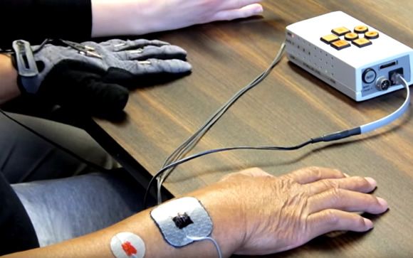 Diseñan un guante de estimulación eléctrica para recuperar la movilidad de la mano tras un ictus