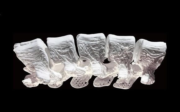 Crean huesos sintéticos impresos en 3D para reparar lesiones óseas
