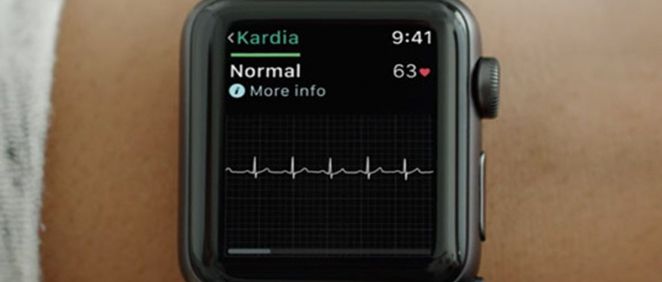 La FDA ha aprobado una correa para practicar electrocardiogramas junto al Apple Watch