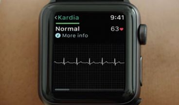 La FDA ha aprobado una correa para practicar electrocardiogramas junto al Apple Watch