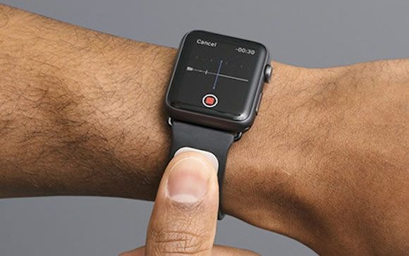 Una correa con sensores convierte el Apple Watch en un electrocardiógrafo
