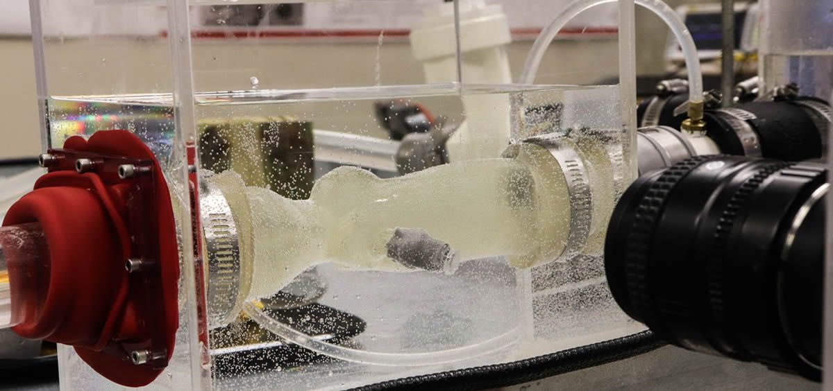 Una réplica impresa en 3D de la válvula aórtica del paciente se prueba en un simulador de alta tecnología