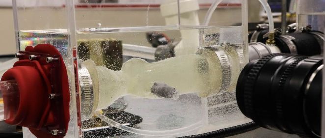 Una réplica impresa en 3D de la válvula aórtica del paciente se prueba en un simulador de alta tecnología