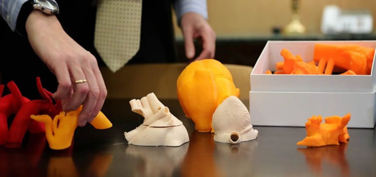 La impresión en 3D en España, un paso más hacia la medicina personalizada