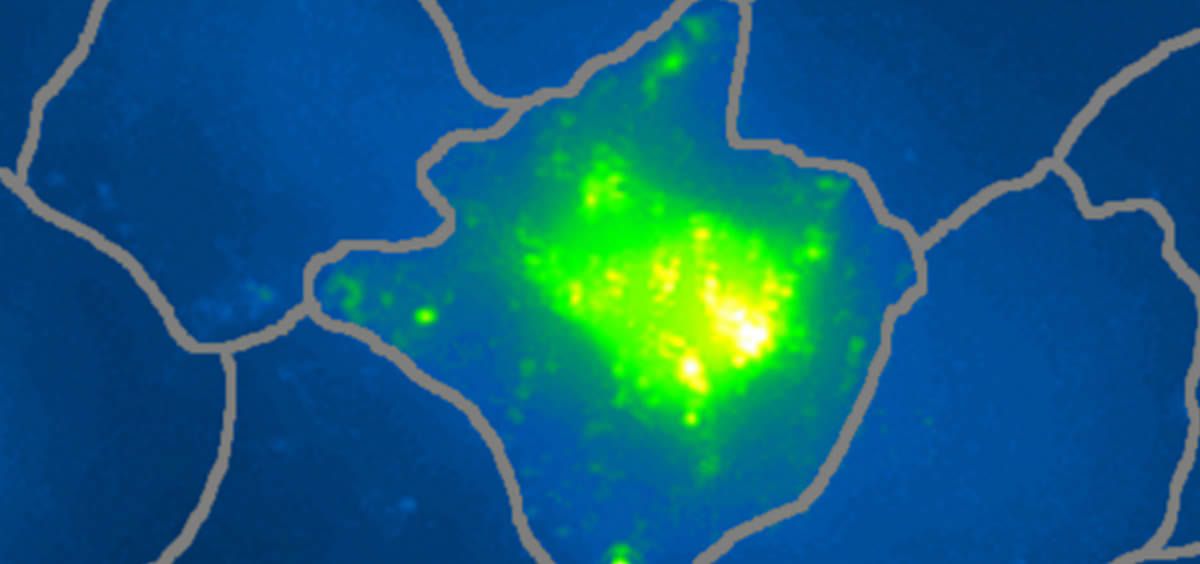 La proteína fluorescente integrada en la nanosonda se activa ante la iluminación de un láser