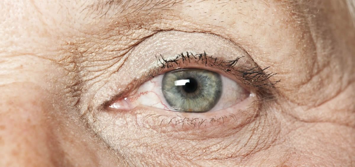 La degeneración macular asociada a la edad afecta a más del 10% de la población mayor de 65 años en los países desarrollados