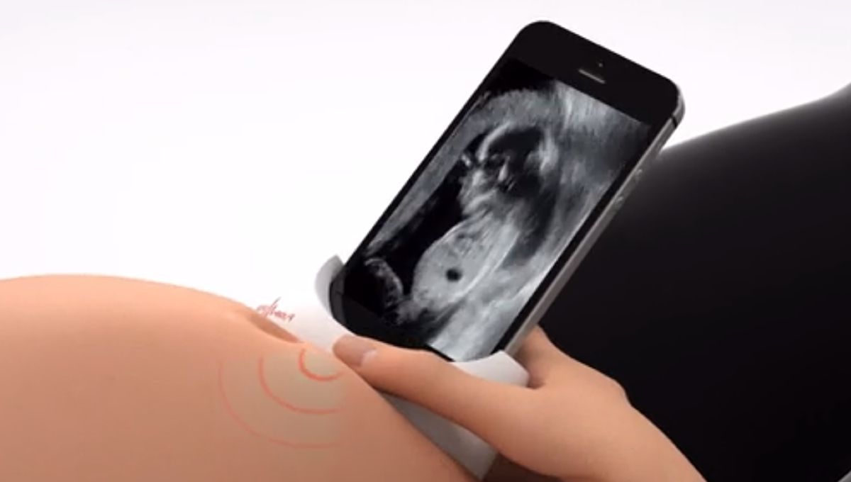 Diseñan un dispositivo para que las embarazadas controlen la salud de su bebé