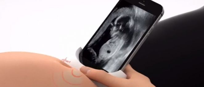 Diseñan un dispositivo para que las embarazadas controlen la salud de su bebé