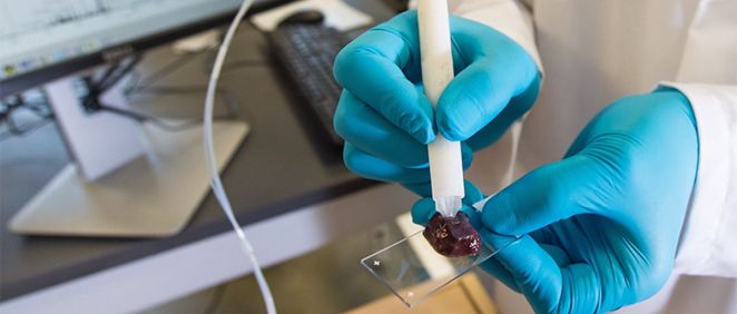 Un bolígrafo detecta las células cancerígenas en segundos