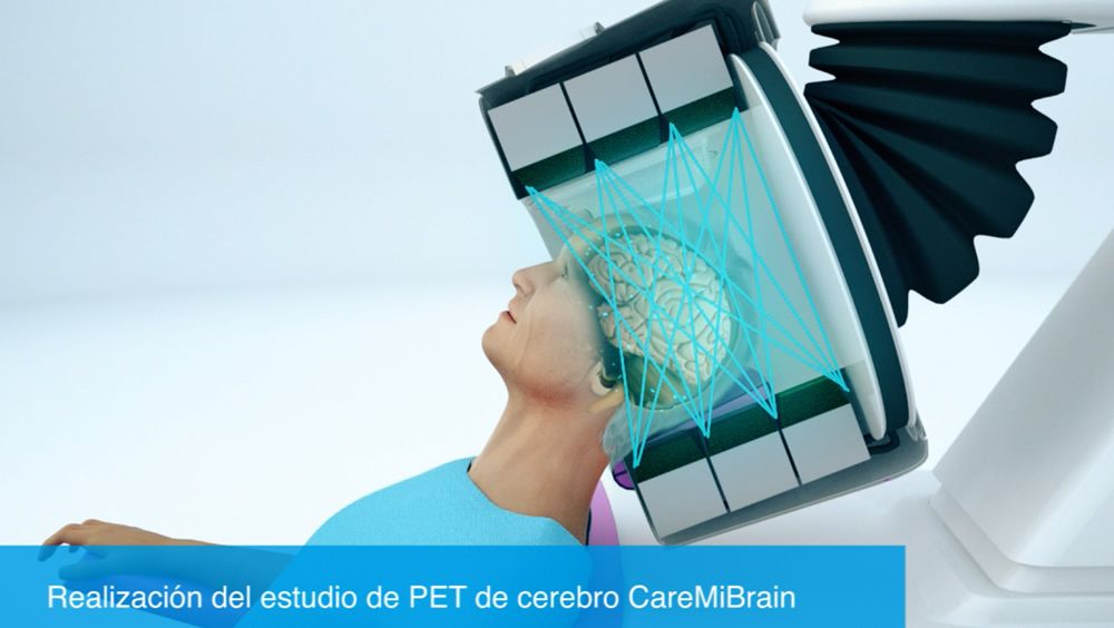 El primer PET de cerebro se está probando en un hospital español