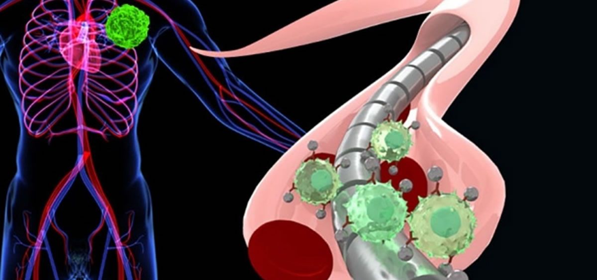 Nuevo dispositivo captura las células tumorales circulantes dentro de los vasos sanguíneos
