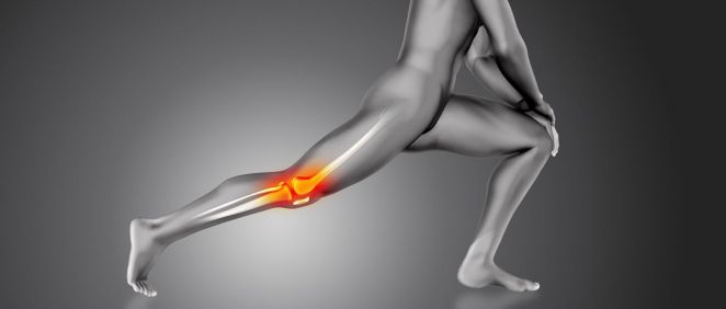 Un implante de cartílago podría ser la solución para sanar rodillas dañadas