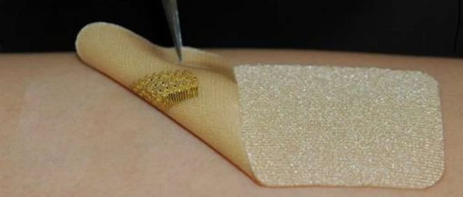 Sensor que imita la piel y permite monitorizar las heridas en tiempo real. Matthew Brown