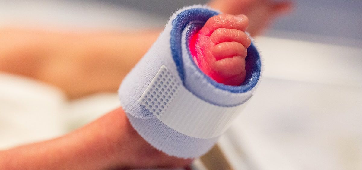 Un chupete inteligente monitorea los niveles de electrolitos en bebés prematuros