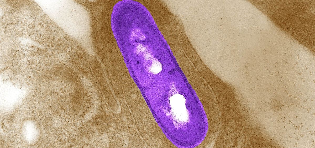 Germen Listeria monocytogenes (Foto. Pixnio)
