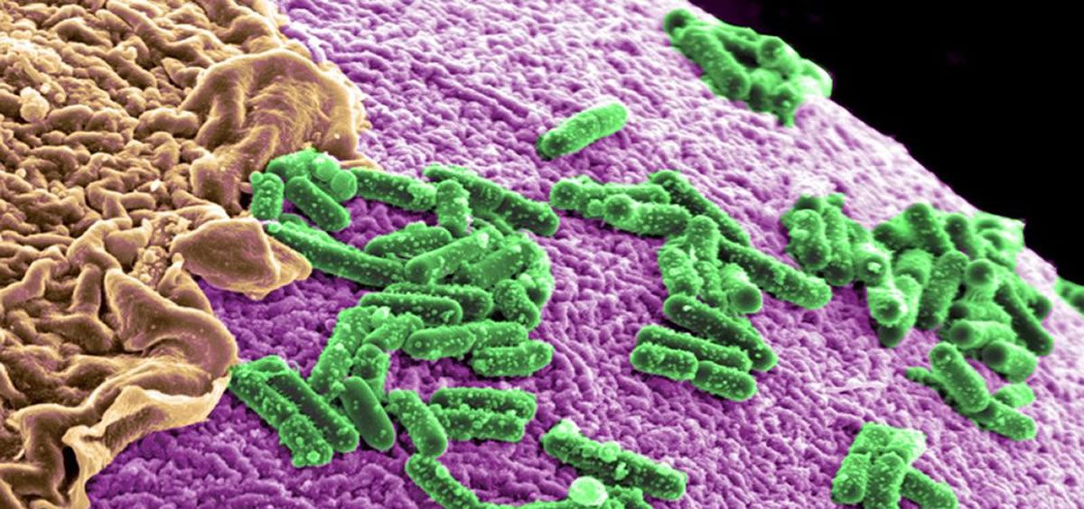 La microbiota intestinal tiene la clave para envejecer de forma saludable (Foto. Pixabay)