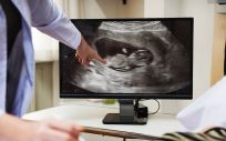 Una ecografía a una mujer embarazada. (Foto. Rawpixel)