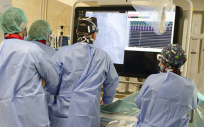 Profesionales del servicio de Cardiología del Hospital Gregorio Marañón realizando una operación (Foto. ConSalud)