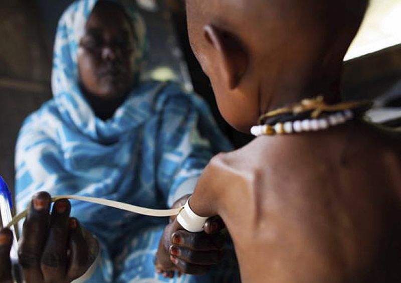 El 80% de los casos de desnutrición en sus formas más agudas se concentran en solo 20 países ubicados en su mayoría en África (Foto. OMS)