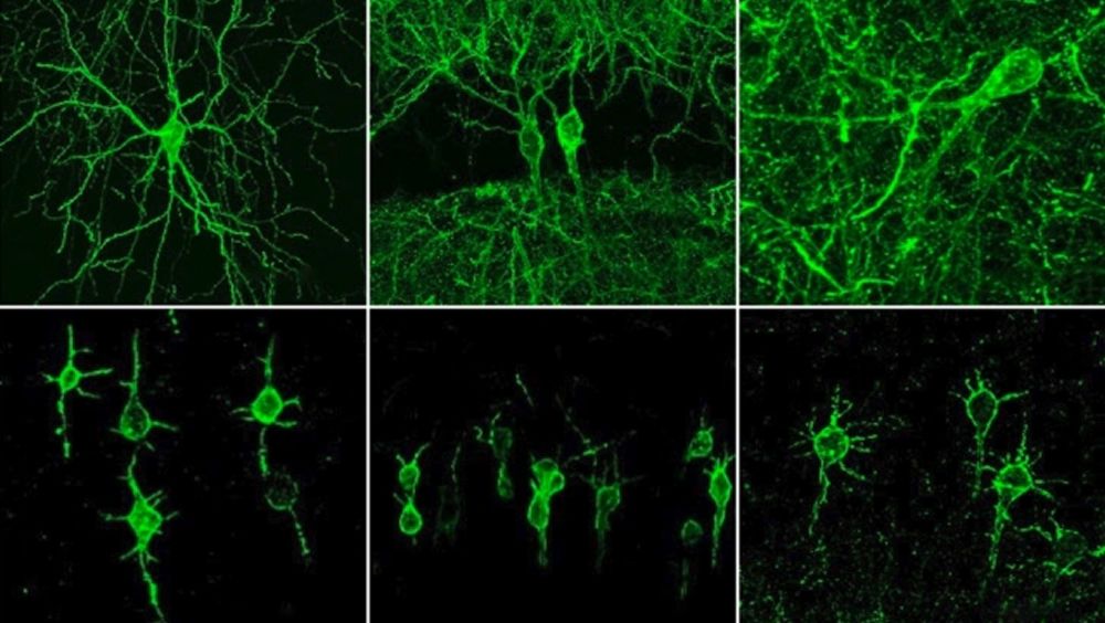 Conexiones entre neuronas en el cerebro (Foto: MIT)