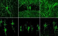 Conexiones entre neuronas en el cerebro (Foto: MIT)