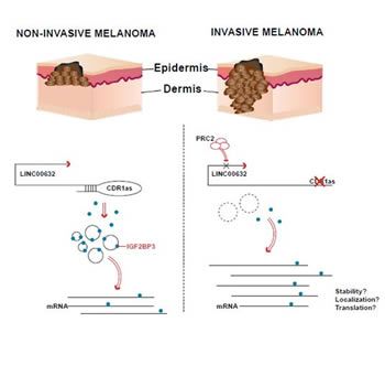 Imagen explicativa sobre el melanoma (Foto. ConSalud)