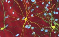 Neurona con el gen HTT (Foto. UPF)