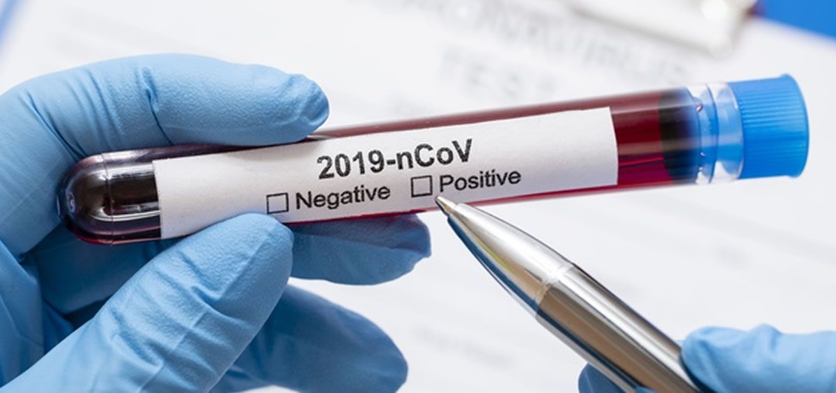 Coronavirus Asi Son Los Test Para Detectar Positivos