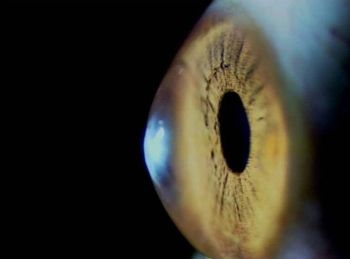 La córnea, la lente más externa del ojo, se debilita con el paso del tiempo (Foto. CSIC)
