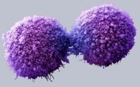 Células de páncreas cancerosas completando la división celular - Getty