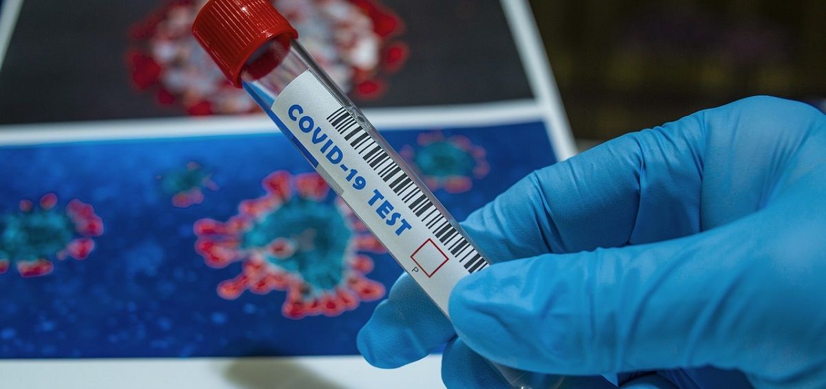 Test PCR de coronavirus Covid-19. (Foto. Pixabay)