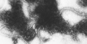 Imagen del virus respiratorio sincitial obtenida por microscopía electrónica (NIAID) (Foto. Isciii)