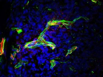 Imagen obtenida por microscopia confocal de células tumorales (en azul) con los vasos sanguíneos que los irrigan (en rojo) donde se observa la proteína de la membrana basal (en verde) que permite que los linfocitos accedan al tumor (Foto. CSIC)