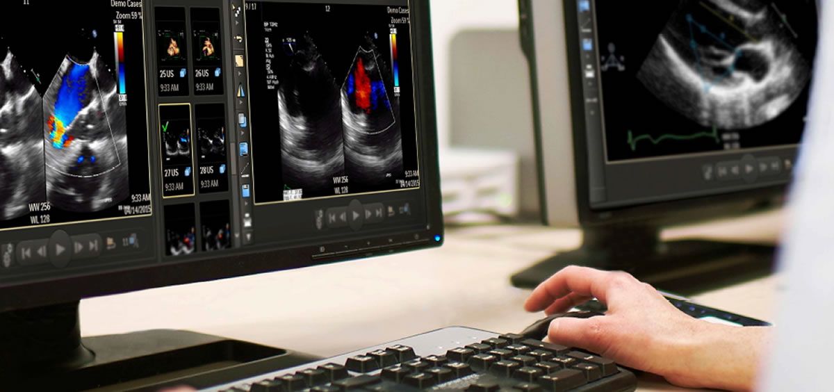 Murcia implanta una solución que mejora el diagnóstico y el tratamiento del paciente cardíaco
