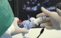 Doctores del Hospital Clínic de Barcelona examinan uno de los dispositivos utilizados en el procedimiento