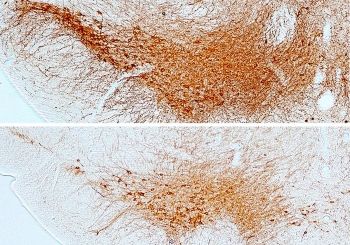 Imagen de las neuronas dopaminérgicas de la sustancia negra del cerebro (Foto. CSIC)