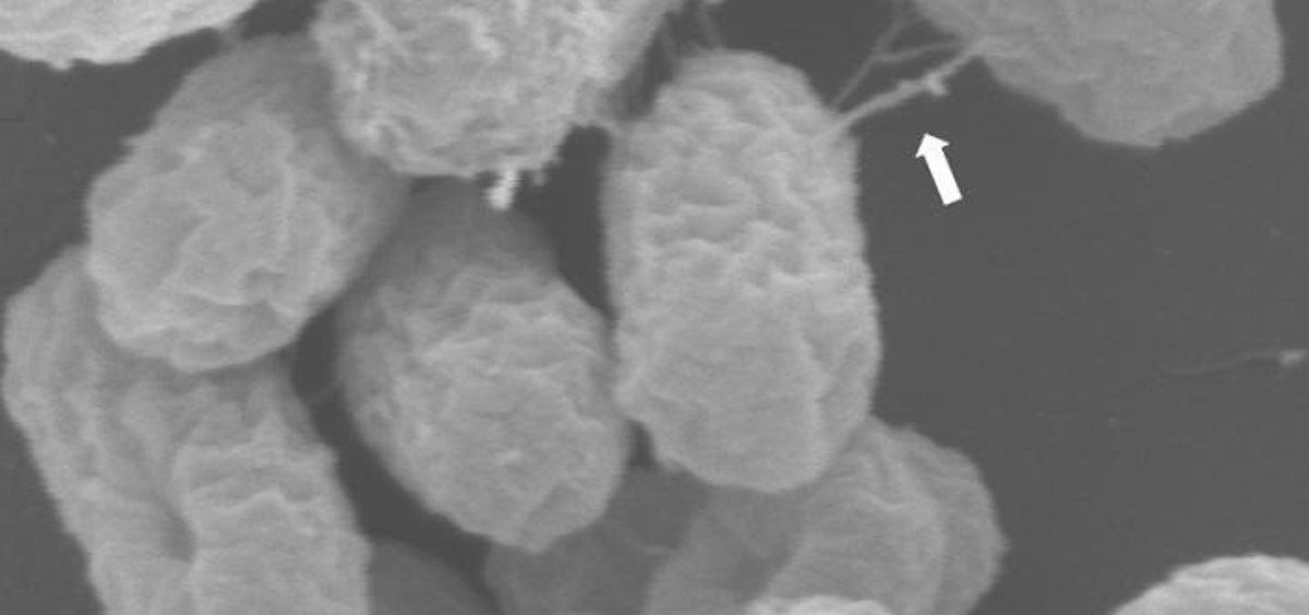 Superbacterias atrapadas en el acto de transferir un plásmido de resistencia a antibióticos a través de su "pilus" similar a una jeringa, marcado con flechas (Foto: EP)