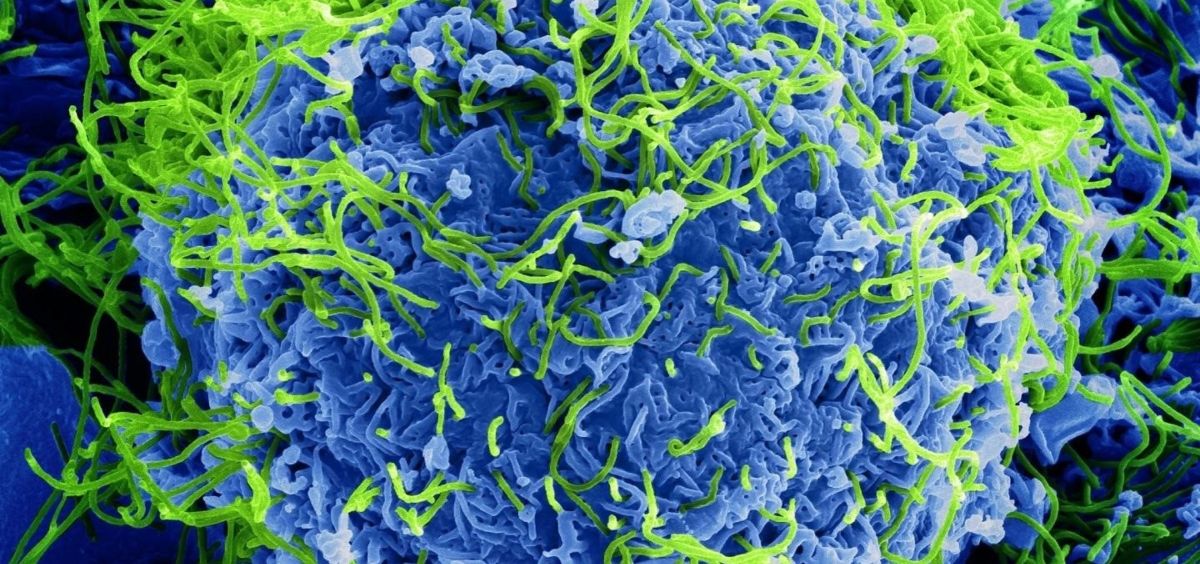 Micrografía electrónica de barrido coloreada de partículas del virus del Ébola (Foto. EP)