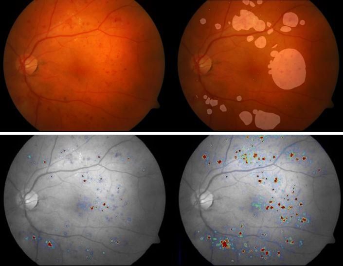 Cuatro etapas diferentes de la misma exploración ocular (Foto. Universidad de Radboud )
